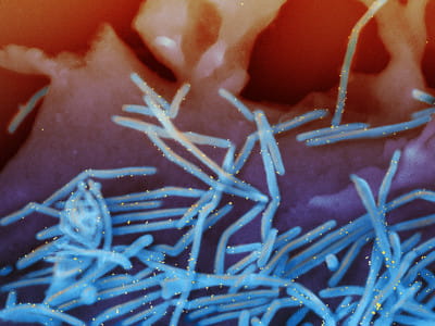 Test organism (without alignment)